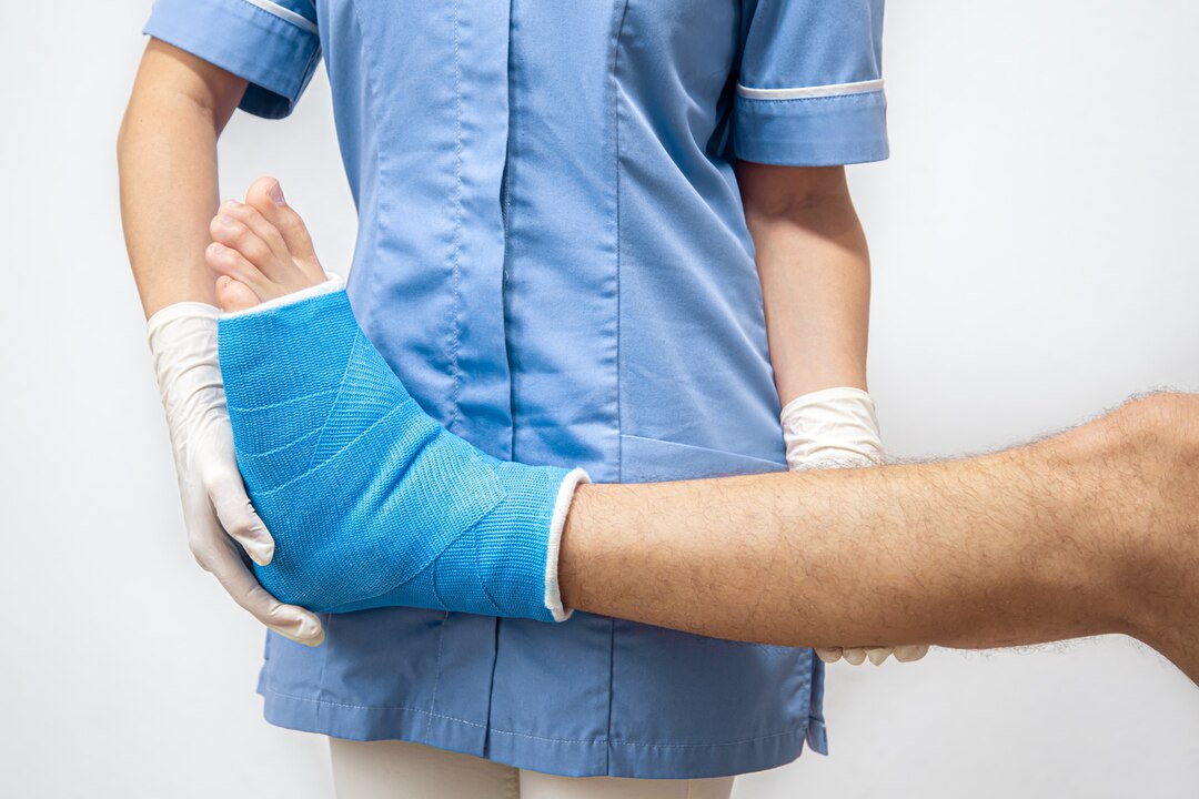 Fracture Treatment — Dr. Ankkur Kumar Pune